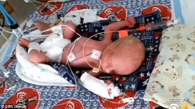 “Lỡ kế hoạch”, bà mẹ 30 tuổi có tới 9 người con