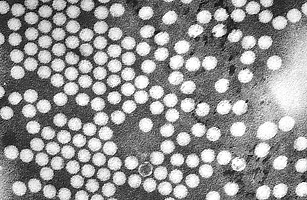 Những đại dịch kinh hoàng trên thế giới Những đại dịch kinh hoàng trên thế giới