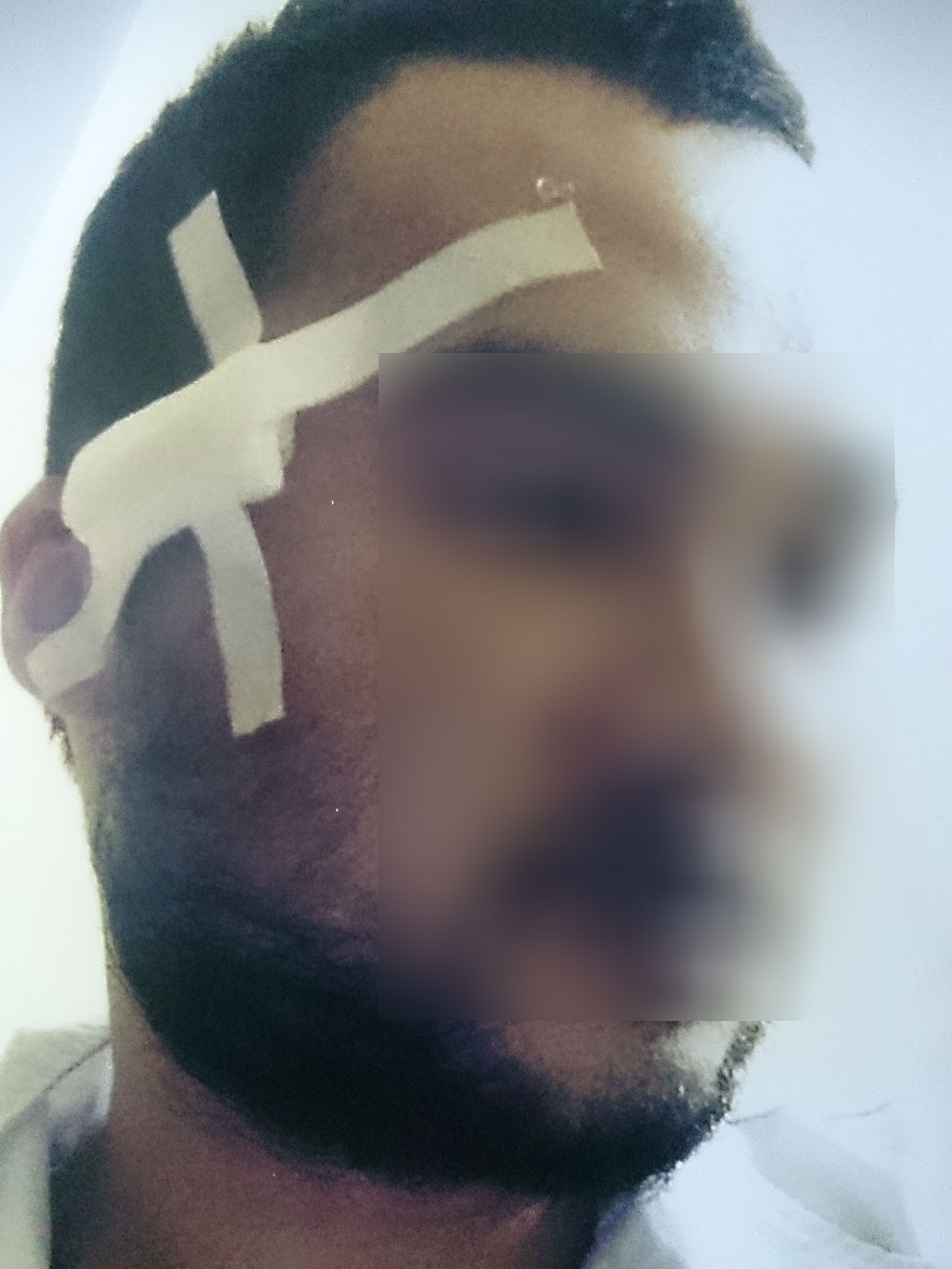 Bị trai làng vây đánh nhập viện vì... va chạm giao thông Bị trai làng vây đánh nhập viện vì... va chạm giao thông