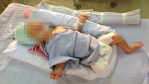 Bé sơ sinh bị văng khỏi bụng mẹ đã bú được sữa