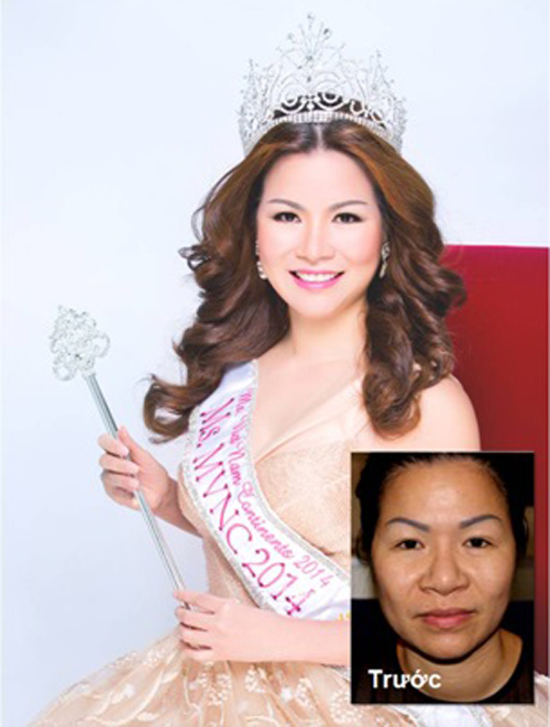 Chuyên gia thẩm mỹ bình luận về nhan sắc của Hoa Hậu Kỳ Duyên Chuyên gia thẩm mỹ bình luận về nhan sắc của Hoa Hậu Kỳ Duyên