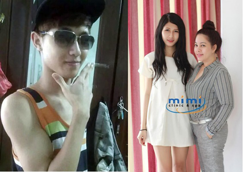 Chuyên gia thẩm mỹ bình luận về nhan sắc của Hoa Hậu Kỳ Duyên Chuyên gia thẩm mỹ bình luận về nhan sắc của Hoa Hậu Kỳ Duyên