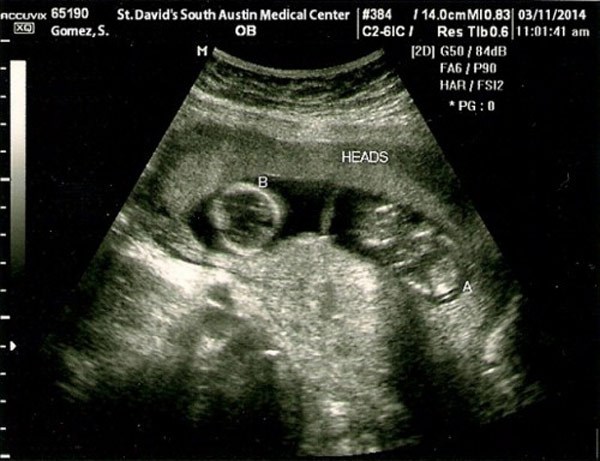 Selena Gomez khoe ảnh nude đập tan tin đồn mang thai 