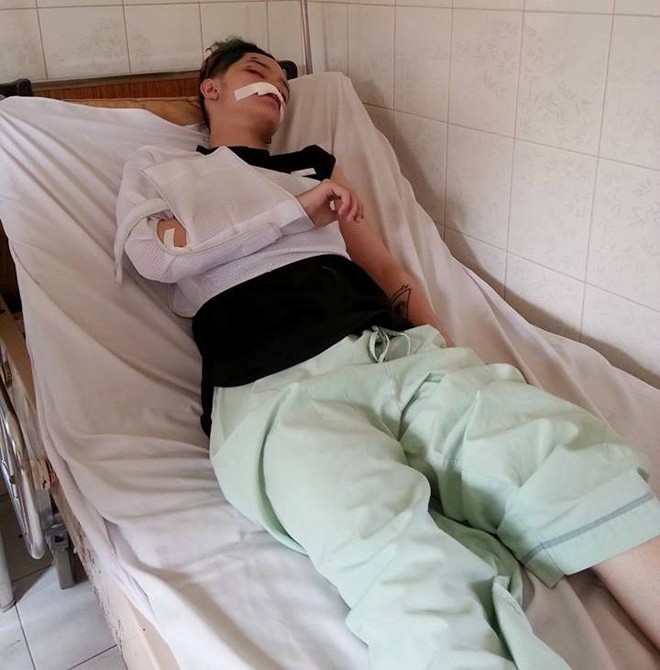 Hot boy Kelbin Lei gặp tai nạn nghiêm trọng vì gặp cướp Hot boy Kelbin Lei gặp tai nạn nghiêm trọng vì gặp cướp