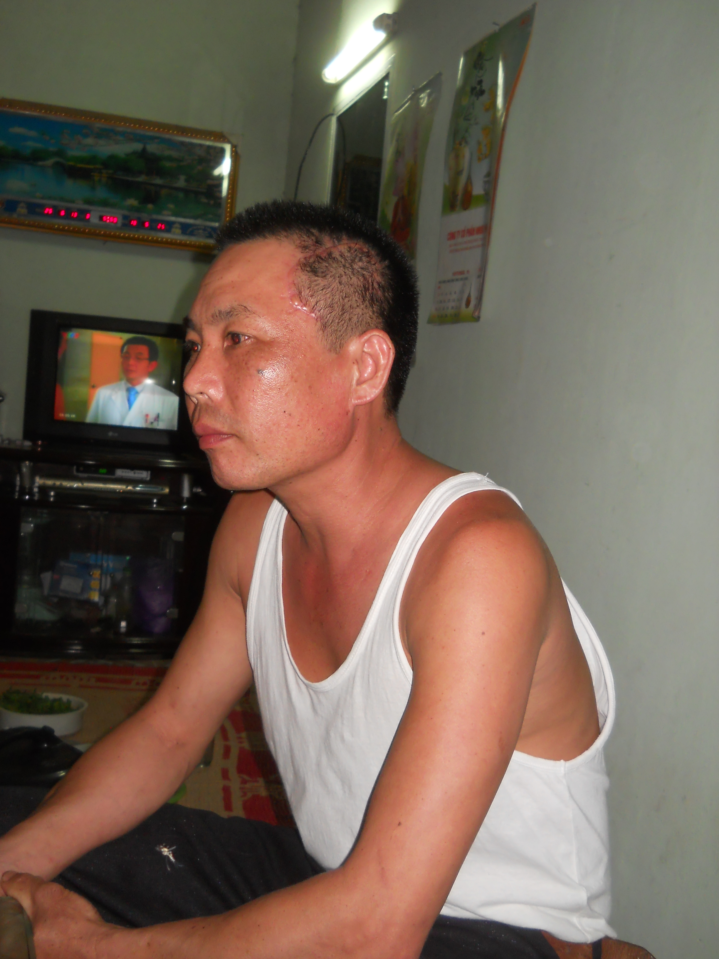 Chém người trọng thương 