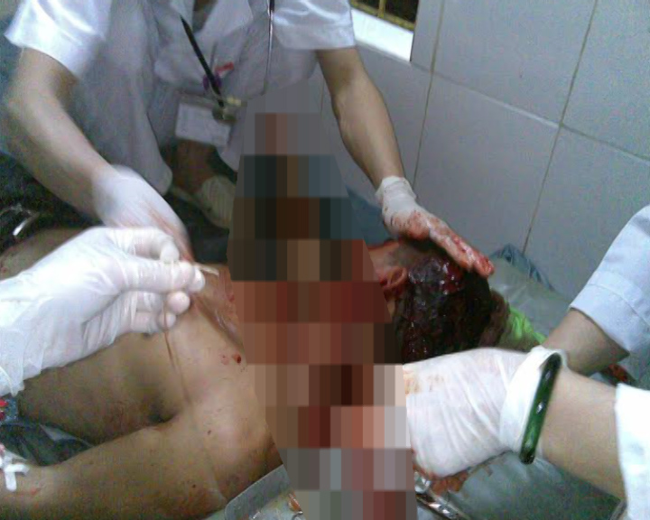 Chém người trọng thương 