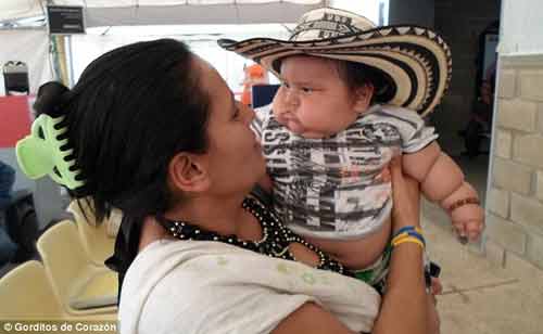 Em bé 8 tháng tuổi siêu béo nặng hơn 20kg