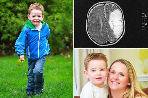 “Phép màu” giúp cậu bé khuyết nửa não giao tiếp và đi lại được “Phép màu” giúp cậu bé khuyết nửa não giao tiếp và đi lại được