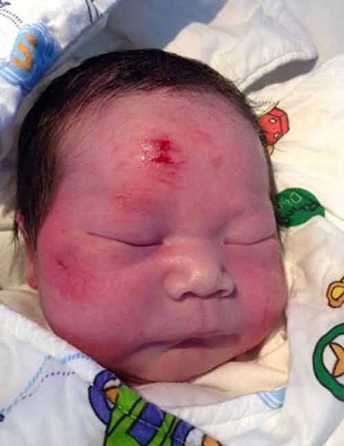 Xúc động bà mẹ vẫn cố sinh con trước khi chết trong tai nạn Xúc động bà mẹ vẫn cố sinh con trước khi chết trong tai nạn