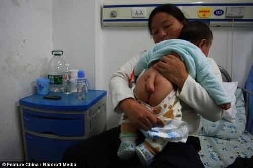 Bà mẹ cầu xin các bác sĩ phẫu thuật “cắt đuôi” cho con trai