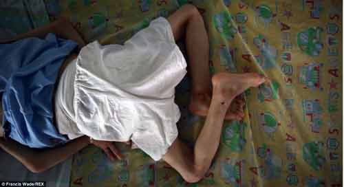 Xót xa hình ảnh trẻ em Việt nhiễm chất độc da cam trên báo Anh Xót xa hình ảnh trẻ em Việt nhiễm chất độc da cam trên báo Anh