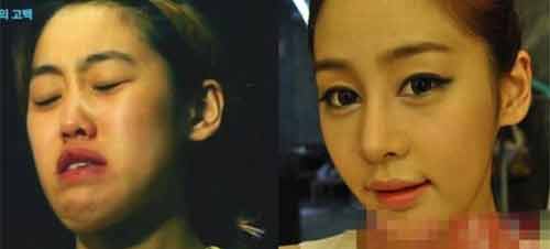 Chồng rút lại đơn ly hôn vì vợ quá xinh sau phẫu thuật thẩm mỹ