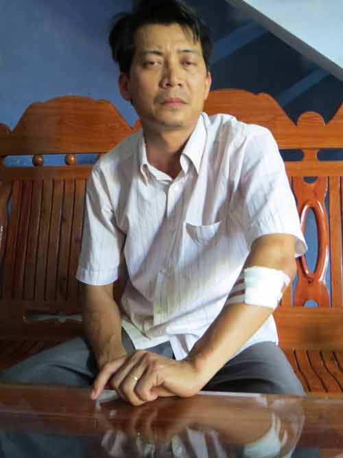 Phú Yên: Dí điện, chém người đi mô tô, cướp hơn 1,5 tỷ đồng Phú Yên: Dí điện, chém người đi mô tô, cướp hơn 1,5 tỷ đồng