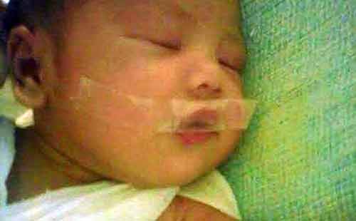 Phẫn nộ y tá bịt miệng trẻ sơ sinh bằng băng keo Phẫn nộ y tá bịt miệng trẻ sơ sinh bằng băng keo