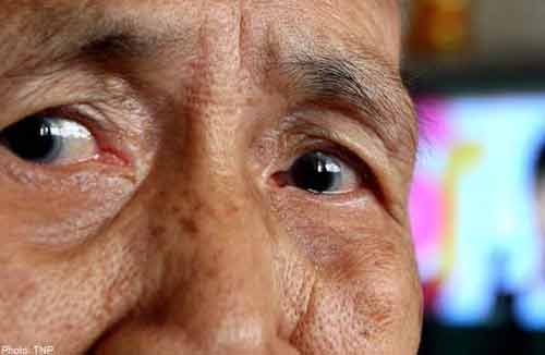 9 bí kíp để giảm nguy cơ mắc đột quỵ 9 bí kíp để giảm nguy cơ mắc đột quỵ