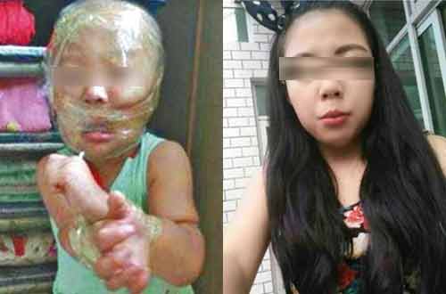 Dân mạng bức xúc cô giáo mầm non dán băng dính khắp đầu em bé