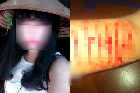 Ba cách trả thù tình “kinh hãi” của giới trẻ