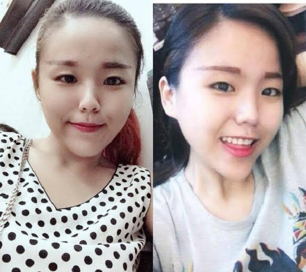 Gặp nữ sinh Hà Nội “lột xác” giảm 53kg trong 8 tháng