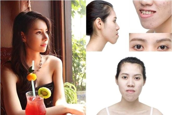 Cuộc “lột xác” của cô gái có gương mặt “Khỉ đột”