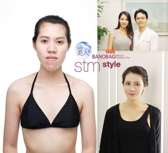 Cuộc “lột xác” của cô gái có gương mặt “Khỉ đột”