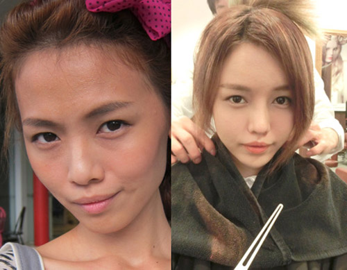 Hot blogger Singapore gây choáng vì khoe “chiến tích dao kéo”