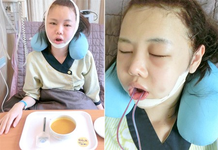 Hot blogger Singapore gây choáng vì khoe “chiến tích dao kéo”