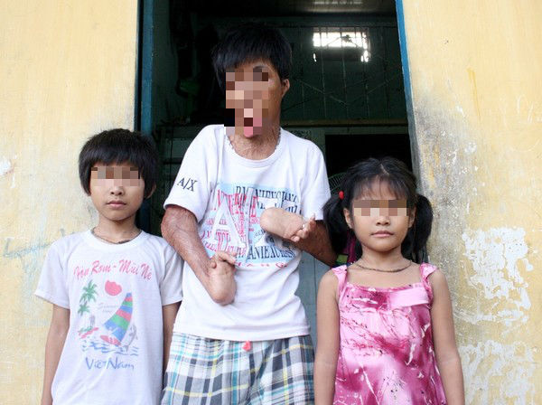 Cuộc sống khổ cực của chàng trai 