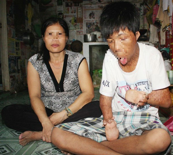 Cuộc sống khổ cực của chàng trai 