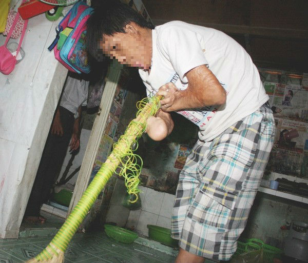 Cuộc sống khổ cực của chàng trai 