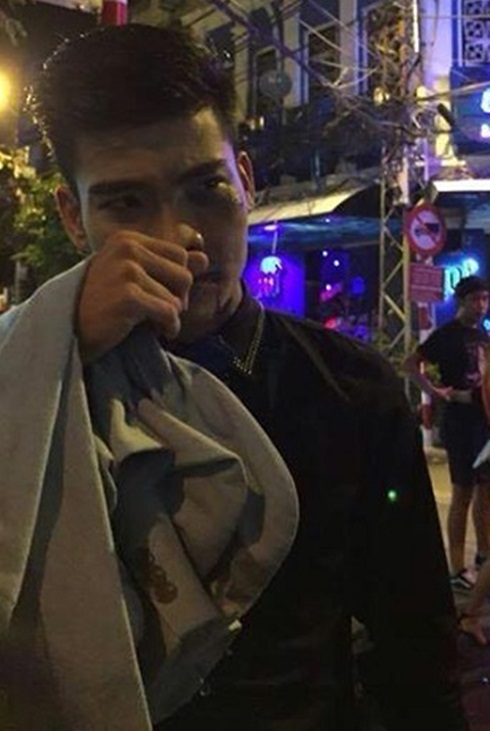 Thực hư vụ chàng trai hóa trang thành Kenny Sang bị đánh bầm dập Thực hư vụ chàng trai hóa trang thành Kenny Sang bị đánh bầm dập