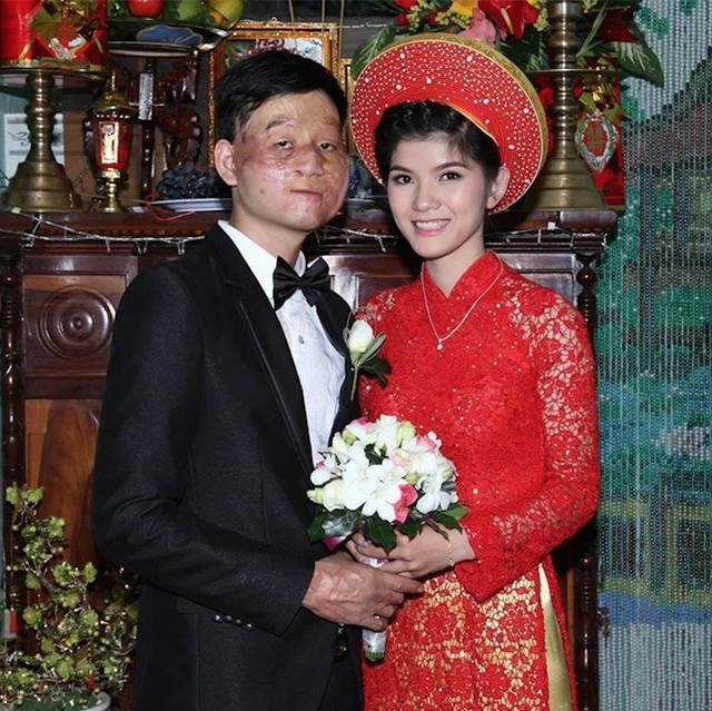 Cặp đôi “Chồng xấu vợ xinh” gây sốt cộng đồng mạng Việt