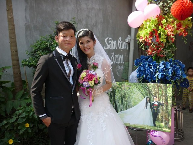 Cặp đôi “Chồng xấu vợ xinh” gây sốt cộng đồng mạng Việt