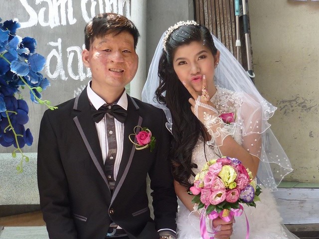 Cặp đôi “Chồng xấu vợ xinh” gây sốt cộng đồng mạng Việt