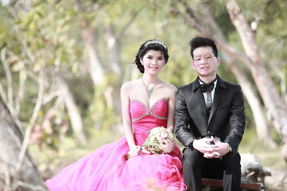 Cặp đôi “Chồng xấu vợ xinh” gây sốt cộng đồng mạng Việt