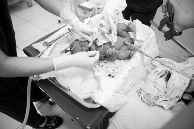 Bộ ảnh chân thực: Chồng chụp khoảnh khắc vợ vượt cạn gây xúc động