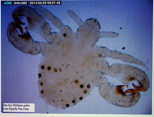 Rận mu tái xuất Rận mu tái xuất