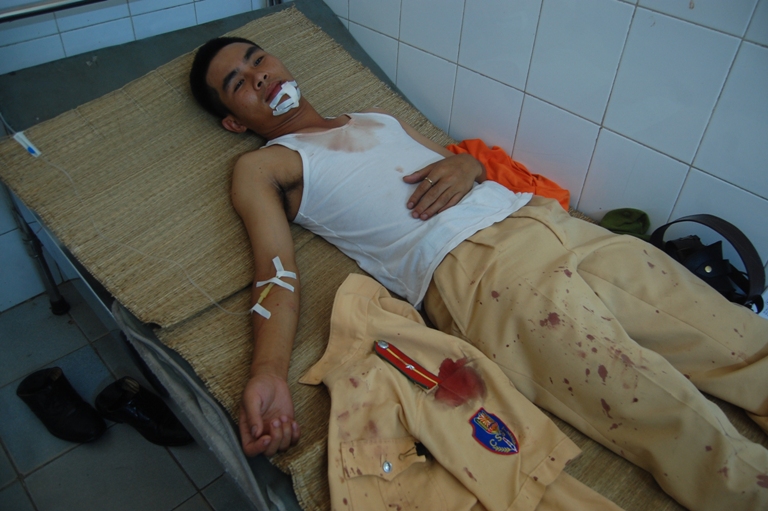 Lăn xả cứu người dân, CSGT bị côn đồ chém trọng thương