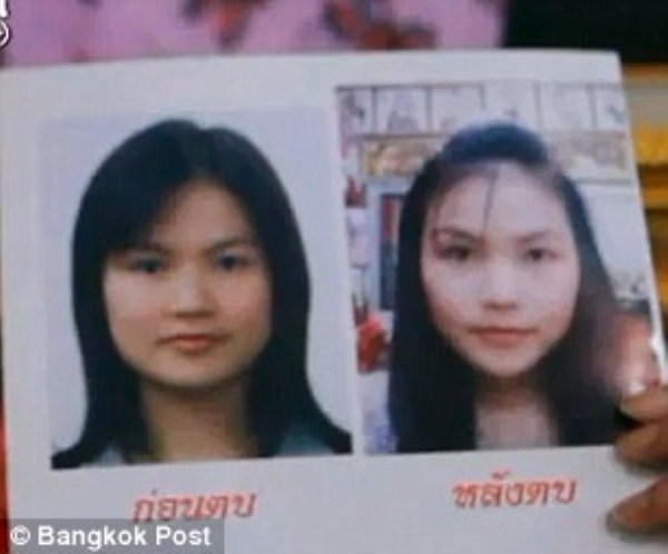 Những phương pháp làm đẹp 'kinh khủng' trên thế giới