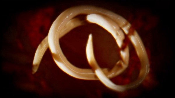 Những phương pháp làm đẹp 'kinh khủng' trên thế giới