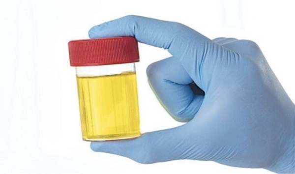 Những phương pháp làm đẹp 'kinh khủng' trên thế giới