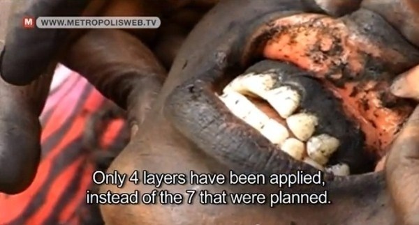 Những phương pháp làm đẹp 'kinh khủng' trên thế giới