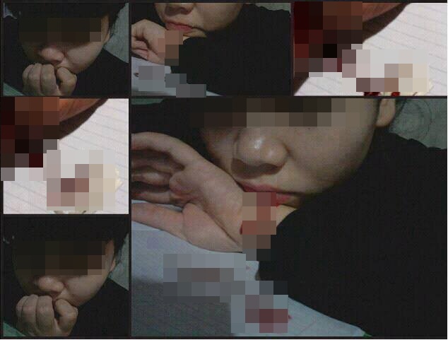 Phản cảm thiếu nữ xinh đẹp, rạch tay khóc lóc thảm thương