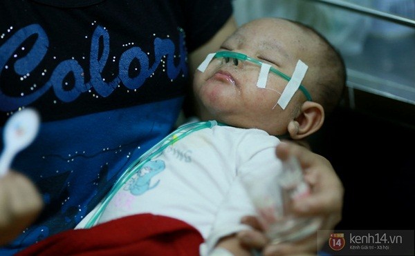 Rớt nước mắt nhìn những em nhỏ gồng mình chống chọi với dịch sởi