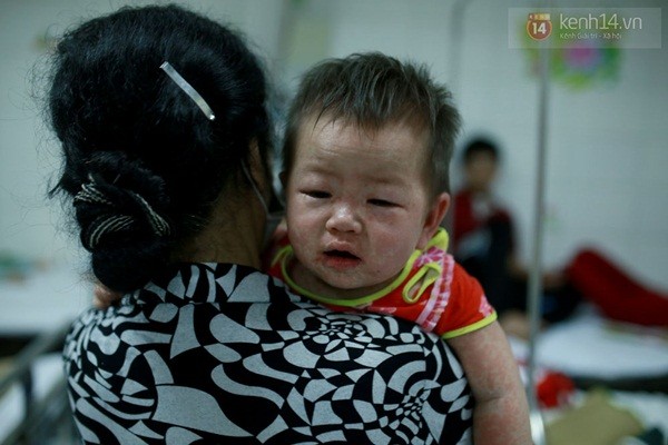 Rớt nước mắt nhìn những em nhỏ gồng mình chống chọi với dịch sởi