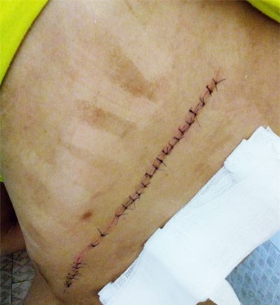 Khánh Hòa: Một phụ nữ bất ngờ bị kẻ Khánh Hòa: Một phụ nữ bất ngờ bị kẻ