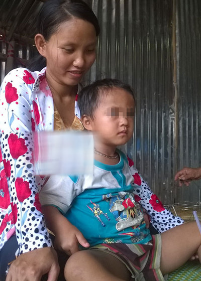 Đau khổ vì sinh con có hai bộ phận sinh dục