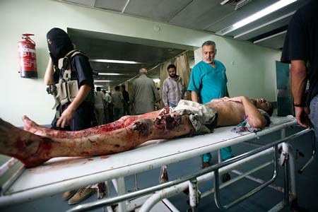 Những hình ảnh đáng sợ về dịch bệnh Ebola