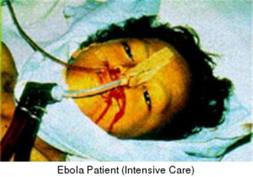 Những hình ảnh đáng sợ về dịch bệnh Ebola
