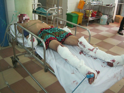 Hiện trường vụ nổ kinh hoàng trên xe giường nằm