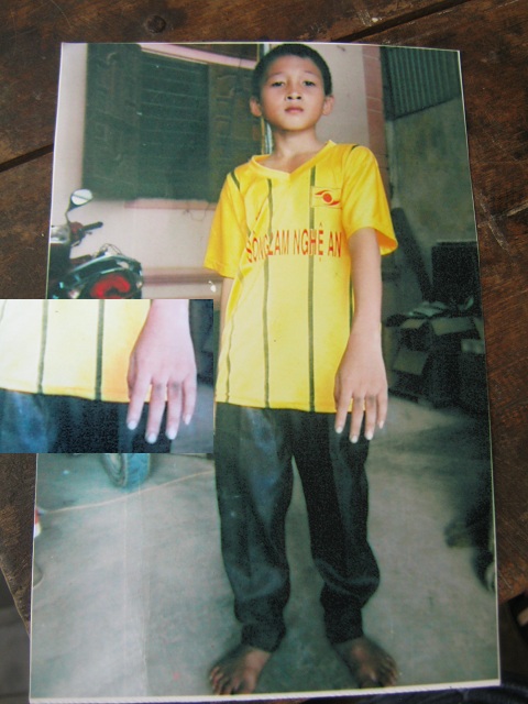 Cán bộ mất chim, bé trai bị 